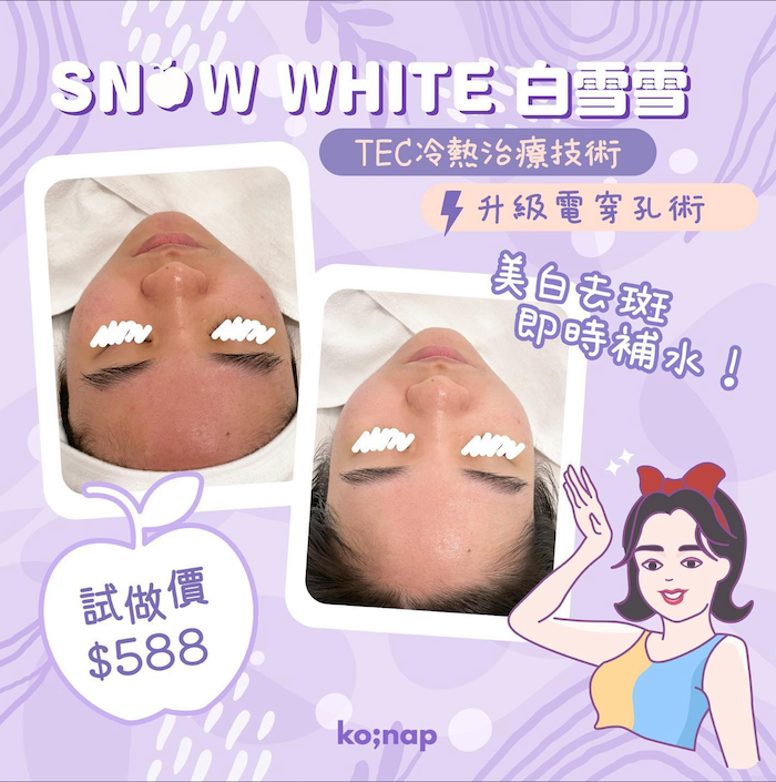 Whitening and Spot Removal Treatment